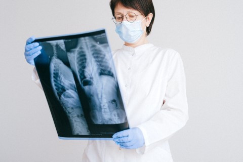 radiographie
